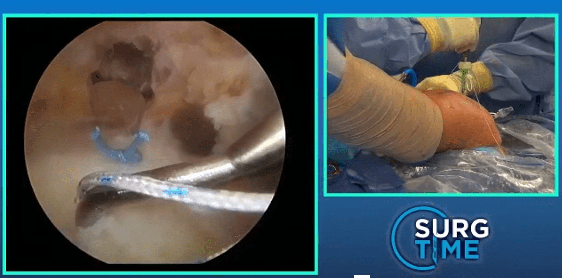 Project 7 | Forest Trail